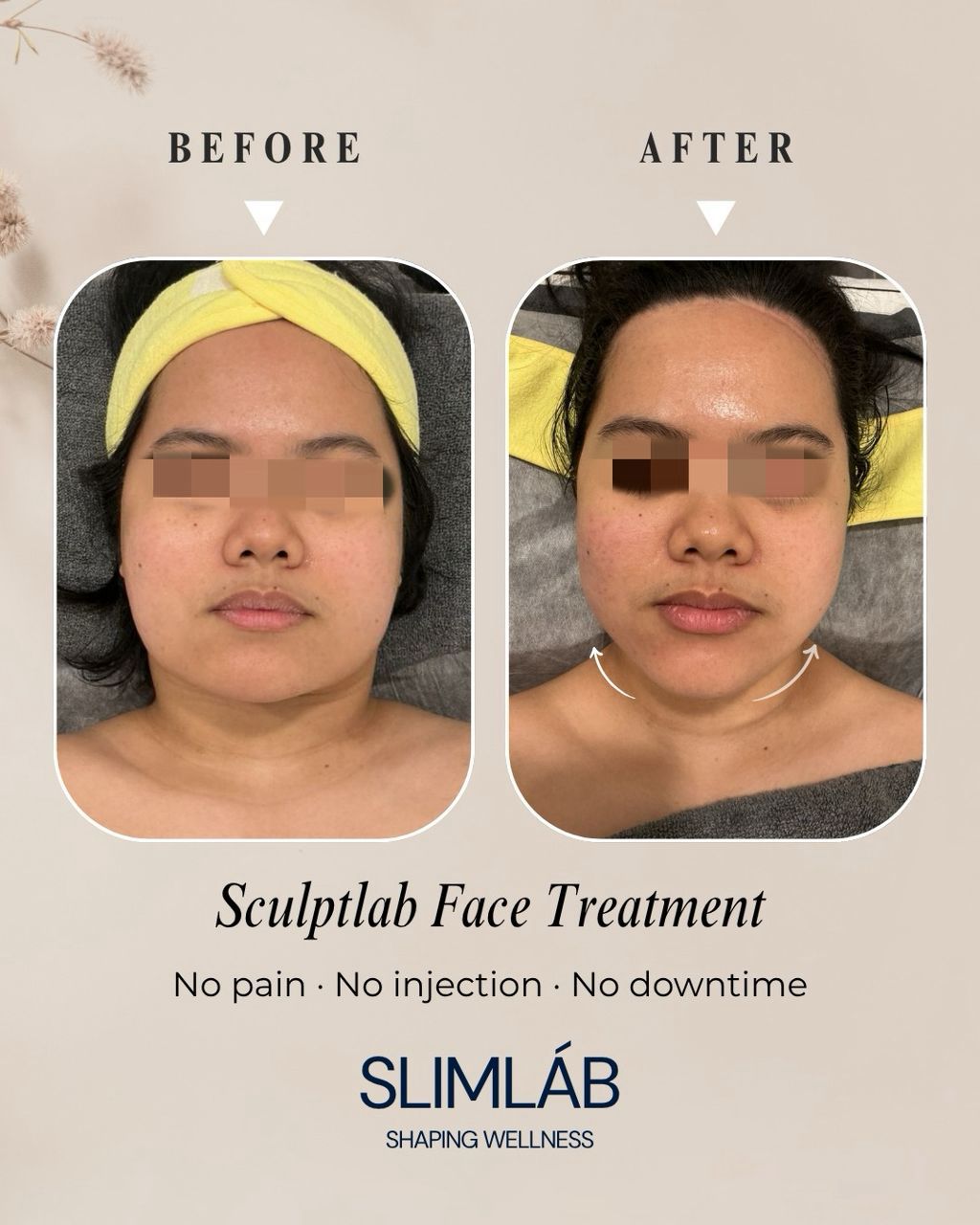 JEMOJE  - Quantum Glow Skin Brightening 